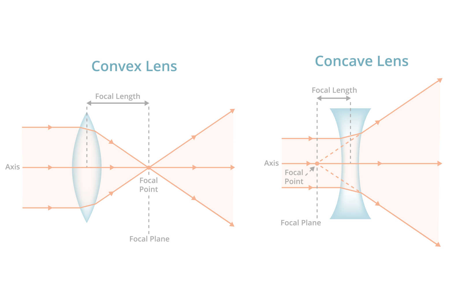 Why Are My Eye Axis So Different? | North York | Ontario