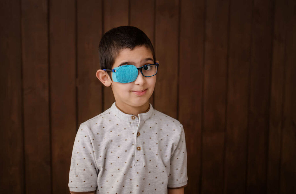 A young boy in glasses with a patch to treat lazy eye. Some studies have indicated patching might help correct a lazy eye in children, but it hasn’t been proven effective in adults.
