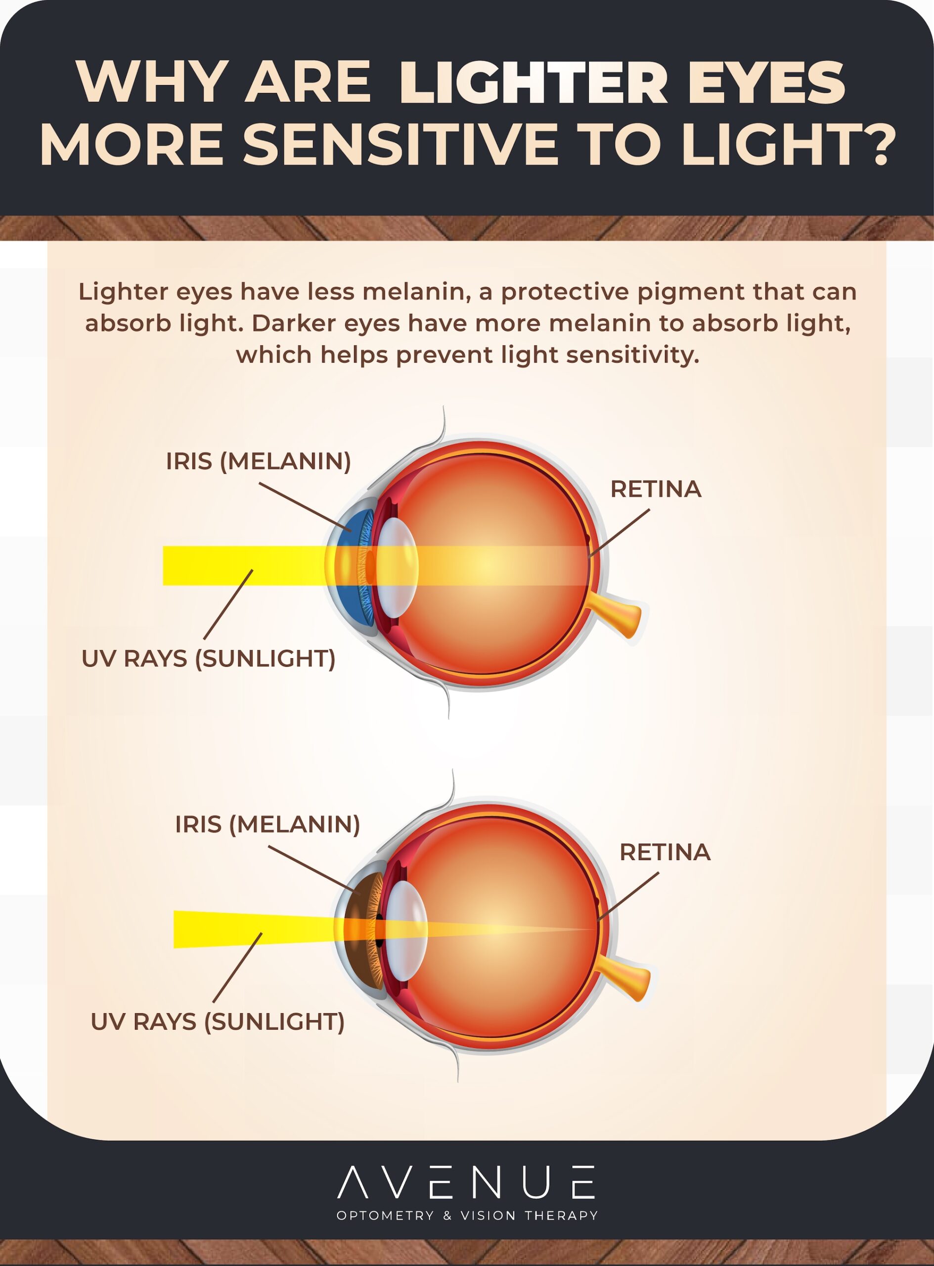 Infographic of two eye cross sections showing how the amount of melanin affects the strength of light entering the eye.